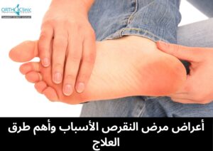 أعراض مرض النقرص الأسباب وأهم طرق العلاج